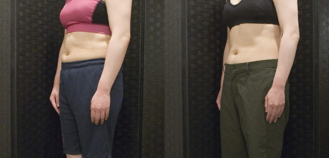 30代女性身長160cm代の方のダイエット事例 パーソナルトレーニング ダイエットジム Burn Out Gym バーンアウトジム